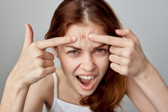 granos en el rostro, How to Remove a Pimple Fast and Without Leaving a Mark