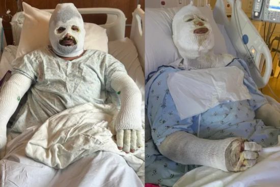 Georgia gas explosion leaves workers injured