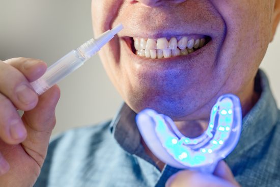 blanqueadores, dentales, casa, dientes, blancos