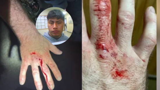 ICE officer assault by undocumented immigrant